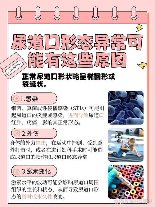 熟妇精品av的相关介绍
