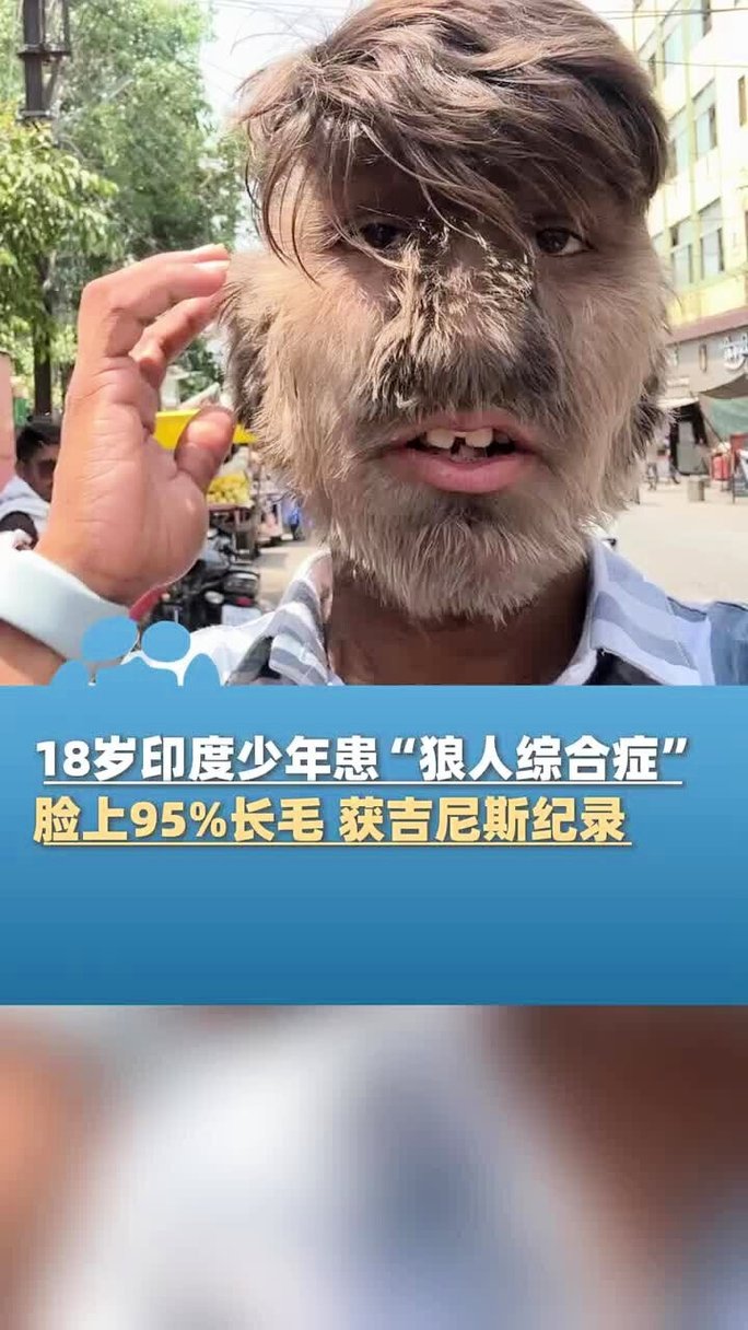 51视频下载app - 免费高清视频下载工具，支持全网解析与极速缓存